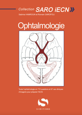 Ophtalmologie - S EDITIONS - Collection SARO - Sabrina HAMROUN, Romain GAROFOLI