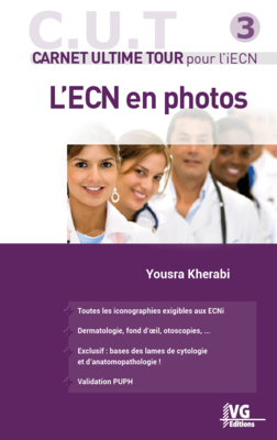 L'ECN en photos - VERNAZOBRES-GREGO - Carnet ultime tour - Yousra KHERABI